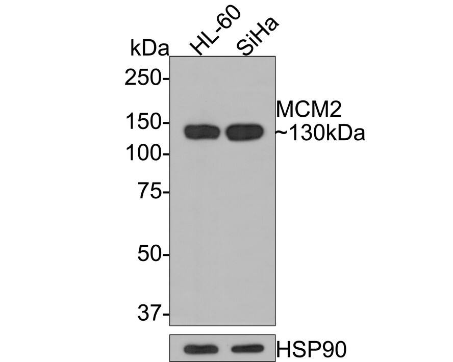 Western Blot: MCM2 Antibody (PD00-90) [NBP3-32576] - Western blot analysis of MCM2 on different lysates with Rabbit anti-MCM2 antibody (NBP3-32576) at 1/2,000 dilution. Lane 1: HL-60 cell lysate Lane 2: SiHa cell lysate Lysates/proteins at 10 ug/Lane. Predicted band size: 102 kDa Observed band size: 130 kDa Exposure time: 1 minute; 8% SDS-PAGE gel. Proteins were transferred to a PVDF membrane and blocked with 5% NFDM/TBST for 1 hour at room temperature. The primary antibody (NBP3-32576) at 1/2,000 dilution was used in 5% NFDM/TBST at room temperature for 2 hours. Goat Anti-Rabbit IgG - HRP Secondary Antibody at 1:300,000 dilution was used for 1 hour at room temperature.