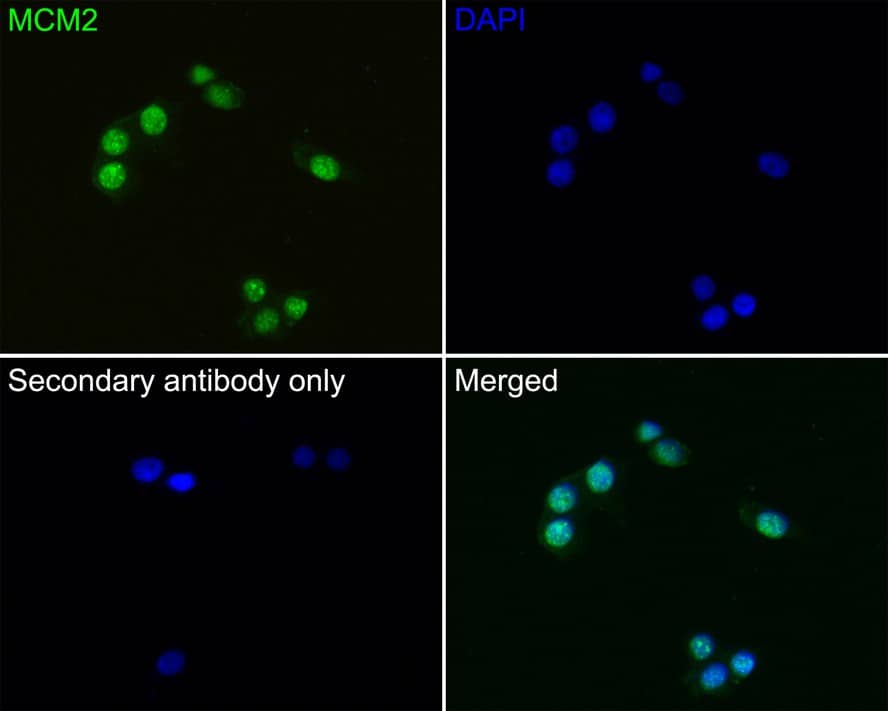 Immunocytochemistry/ Immunofluorescence: MCM2 Antibody (PD00-90) [NBP3-32576] - Immunocytochemistry analysis of LOVO cells labeling MCM2 with Rabbit anti-MCM2 antibody (NBP3-32576) at 1/50 dilution. Cells were fixed in 4% paraformaldehyde for 10 minutes at 37 ℃, permeabilized with 0.05% Triton X-100 in PBS for 20 minutes, and then blocked with 2% negative goat serum for 30 minutes at room temperature. Cells were then incubated with Rabbit anti-MCM2 antibody (NBP3-32576) at 1/50 dilution in 2% negative goat serum overnight at 4 ℃. Goat Anti-Rabbit IgG H&L (iFluor™ 488) was used as the secondary antibody at 1/1,000 dilution. PBS instead of the primary antibody was used as the secondary antibody only control. Nuclear DNA was labelled in blue with DAPI.