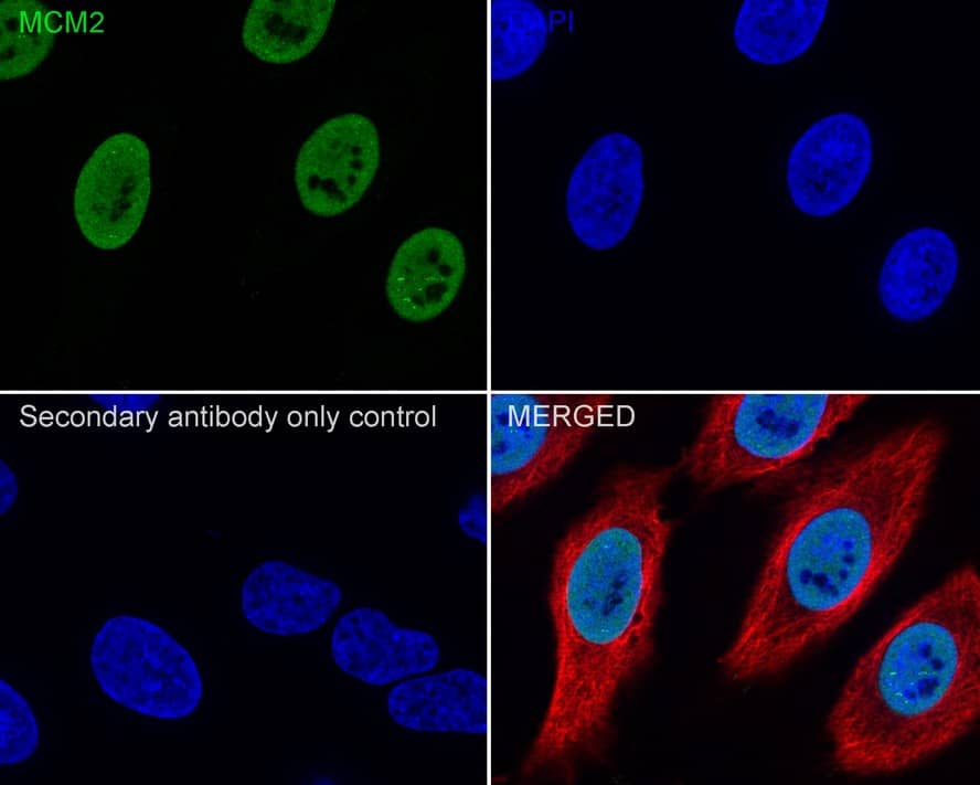Immunocytochemistry/ Immunofluorescence: MCM2 Antibody (JE42-39) [NBP3-32577] - Immunocytochemistry analysis of HeLa cells labeling MCM2 with Rabbit anti-MCM2 antibody (NBP3-32577) at 1/250 dilution. Cells were fixed in 100% precooled methanol for 5 minutes at room temperature, then blocked with 1% BSA in 10% negative goat serum for 1 hour at room temperature. Cells were then incubated with Rabbit anti-MCM2 antibody (NBP3-32577) at 1/250 dilution in 1% BSA in PBST overnight at 4 ℃. Goat Anti-Rabbit IgG H&L (iFluor™ 488) was used as the secondary antibody at 1/1,000 dilution. PBS instead of the primary antibody was used as the secondary antibody only control. Nuclear DNA was labelled in blue with DAPI. Beta tubulin (red) was stained at 1/100 dilution overnight at +4℃. Goat Anti-Mouse IgG H&L (iFluor™ 594) was used as the secondary antibody at 1/1,000 dilution.
