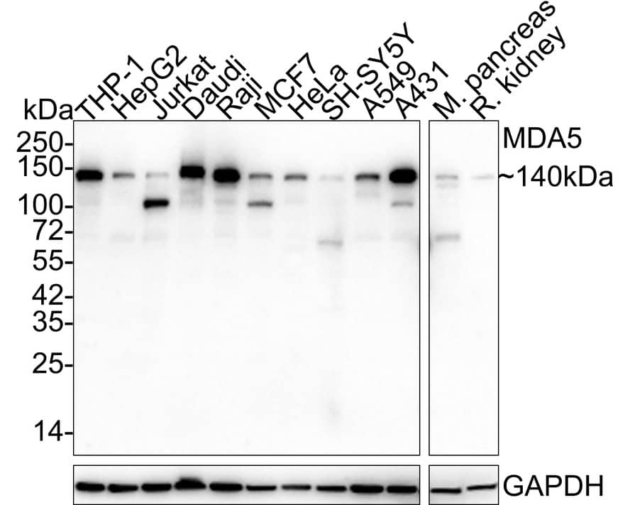 Western Blot: MDA5 Antibody (PSH03-56) [NBP3-32581] - Western blot analysis of MDA5 on different lysates with Rabbit anti-MDA5 antibody (NBP3-32581) at 1/2,000 dilution. Lane 1: THP-1 cell lysate (20 ug/Lane) Lane 2: HepG2 cell lysate (20 ug/Lane) Lane 3: Jurkat cell lysate (20 ug/Lane) Lane 4: Daudi cell lysate (20 ug/Lane) Lane 5: Raji cell lysate (20 ug/Lane) Lane 6: MCF7 cell lysate (20 ug/Lane) Lane 7: HeLa cell lysate (20 ug/Lane) Lane 8: SH-SY5Y cell lysate (20 ug/Lane) Lane 9: A549 cell lysate (20 ug/Lane) Lane 10: A431 cell lysate (20 ug/Lane) Lane 11: Mouse pancreas tissue lysate (40 ug/Lane) Lane 12: Rat kidney tissue lysate (40 ug/Lane) Lysates/proteins at 10 ug/Lane. Predicted band size: 117 kDa Observed band size: 140/100 kDa Exposure time: 3 minutes; 4-20% SDS-PAGE gel. Proteins were transferred to a PVDF membrane and blocked with 5% NFDM/TBST for 1 hour at room temperature. The primary antibody (NBP3-32581) at 1/2,000 dilution was used in 5% NFDM/TBST at 4  overnight. Goat Anti-Rabbit IgG - HRP Secondary Antibody at 1/50,000 dilution was used for 1 hour at room temperature.