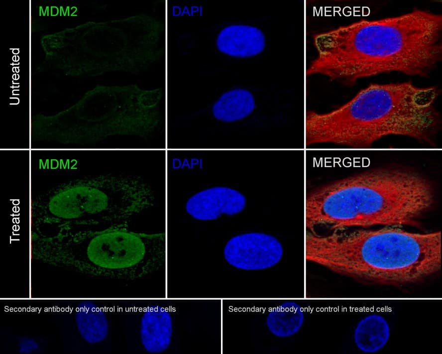 Immunocytochemistry/ Immunofluorescence: MDM2/HDM2 Antibody (A10E11-R) [NBP3-32584] - Immunocytochemistry analysis of U-2 OS cells treated with or without 10μM NUTLIN 3A for 24 hours labeling MDM2/HDM2 with Mouse anti-MDM2/HDM2 antibody (NBP3-32584) at 1/500 dilution. Cells were fixed in 4% paraformaldehyde for 20 minutes at room temperature, permeabilized with 0.1% Triton X-100 in PBS for 5 minutes at room temperature, then blocked with 1% BSA in 10% negative goat serum for 1 hour at room temperature. Cells were then incubated with Mouse anti-MDM2/HDM2 antibody (NBP3-32584) at 1/500 dilution in 1% BSA in PBST overnight at 4 ℃. Goat Anti-Mouse IgG H&L (iFluor™ 488) was used as the secondary antibody at 1/1,000 dilution. PBS instead of the primary antibody was used as the secondary antibody only control. Nuclear DNA was labelled in blue with DAPI. beta Tubulin (red) was stained at 1/100 dilution overnight at +4℃. Goat Anti-Rabbit IgG H&L (iFluor™ 594) were used as the secondary antibody at 1/1,000 dilution.