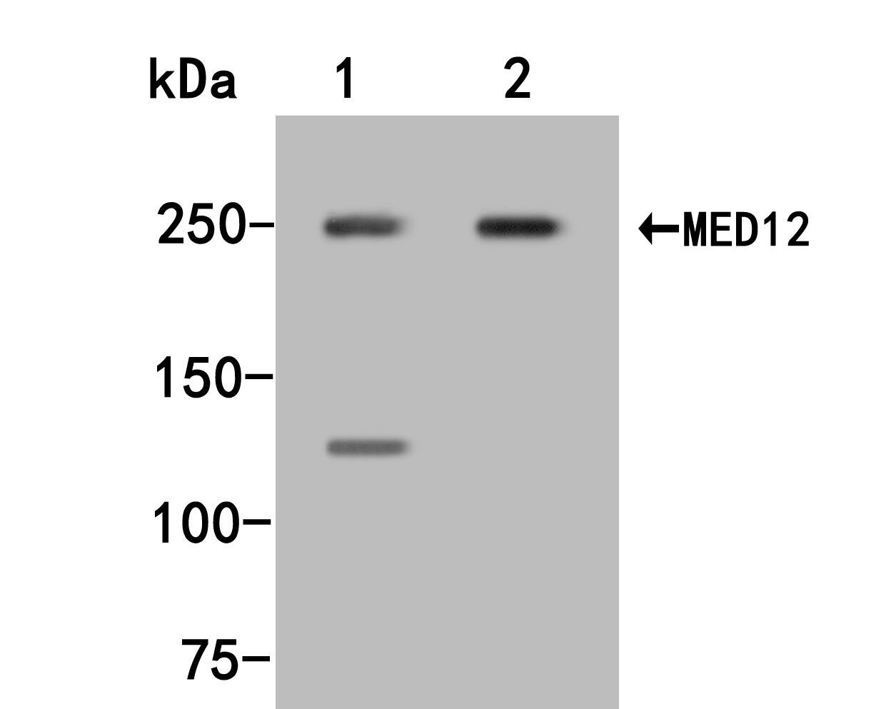 Western blot analysis on different lysates with NBP3-32585 at 1/500 dilution. Lane 1: Hela cell lysate Lane 2: K562 cell lysate Lysates/proteins at 10 µg/Lane. Predicted band size: 243 kDa Observed band size: 243 kDa Exposure time: 2 minutes; 10% SDS-PAGE gel. Proteins were transferred to a PVDF membrane and blocked with 5% NFDM/TBST for 1 hour at room temperature. NBP3-32585 at 1/500 dilution was used in 5% NFDM/TBST at room temperature for 2 hours. Goat Anti-Rabbit IgG [HRP] Secondary Antibody at 1:200,000 dilution was used for 1 hour at room temperature.