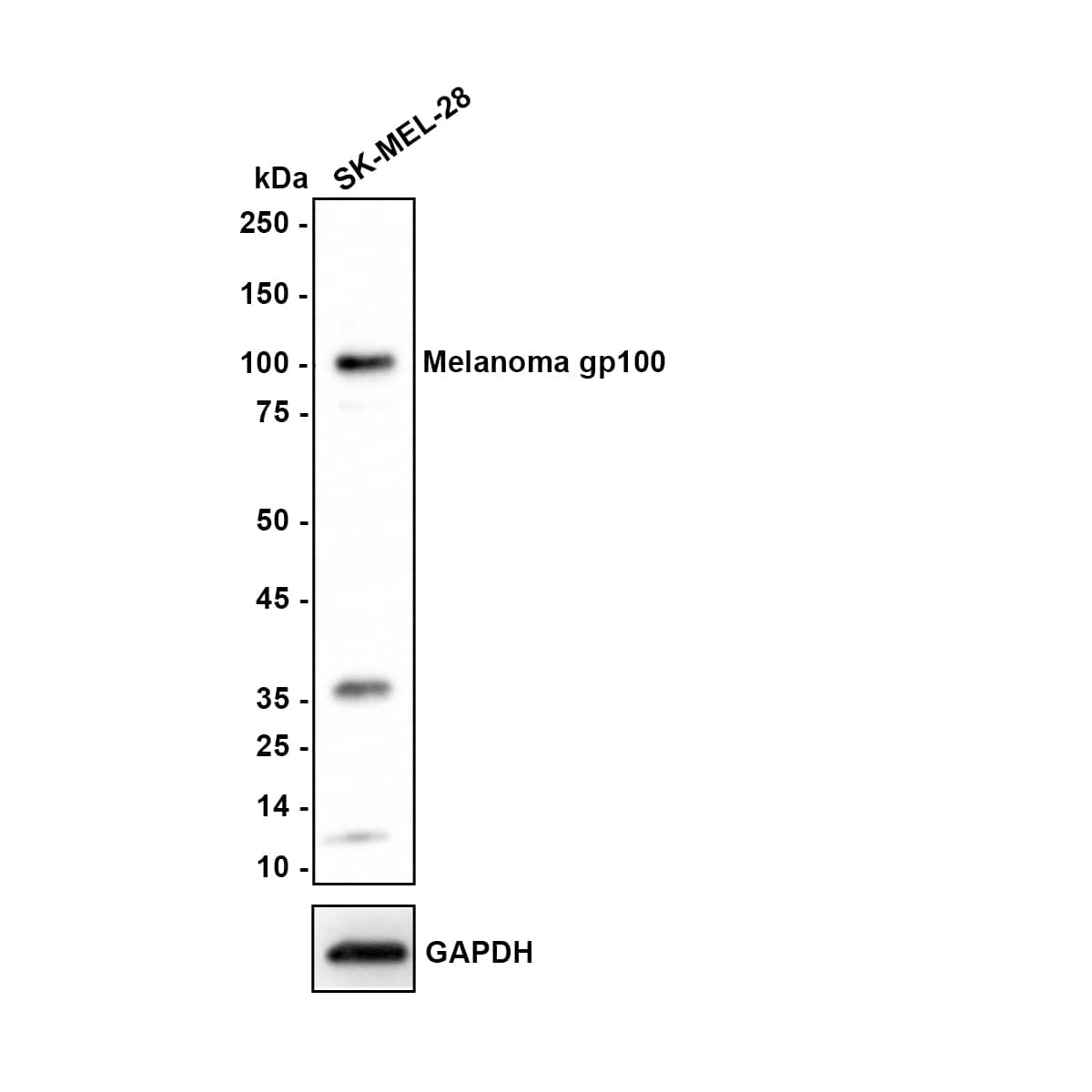 Western blot analysis of  SK-MEL-28 cell lysates with NBP3-32586 at 1/1,000 dilution. Lysates/proteins at 20 µg/Lane. Predicted band size: 70 kDa Observed band size: 100 kDa Exposure time: 2 minutes;
