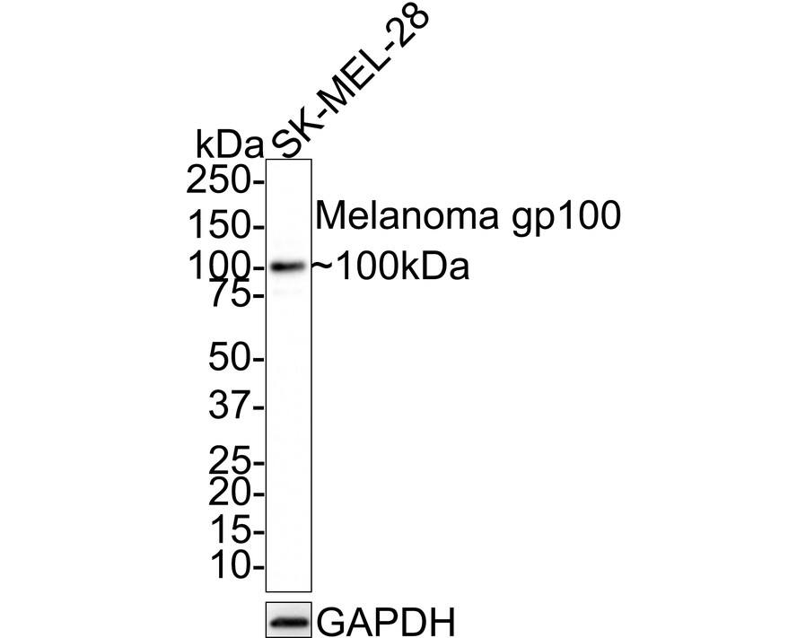 Western Blot: PMEL17/SILV Antibody (JE42-47) [NBP3-32586] - Western blot analysis of PMEL17/SILV on SK-MEL-28 cell lysates with Rabbit anti-PMEL17/SILV antibody (NBP3-32586) at 1/1,000 dilution. Lysates/proteins at 20 ug/Lane. Predicted band size: 70 kDa Observed band size: 100 kDa Exposure time: 2 minutes; 4-20% SDS-PAGE gel. Proteins were transferred to a PVDF membrane and blocked with 5% NFDM/TBST for 1 hour at room temperature. The primary antibody (NBP3-32586) at 1/1,000 dilution was used in 5% NFDM/TBST at room temperature for 2 hours. Goat Anti-Rabbit IgG - HRP Secondary Antibody at 1/100,000 dilution was used for 1 hour at room temperature.