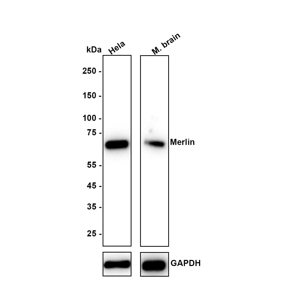 Western blot analysis on different lysates with NBP3-32589 at 1/5,000 dilution. Lane 1: HeLa (Human cervical adenocarcinoma cell) cell lysate Lane 2: Mouse brain tissue lysate Lysates/proteins at 25 µg/Lane. Exposure time: 59 Seconds Blocking: 5% NFDM/TBST, 1 hour at room temperature Primary antibody: NBP3-32589, 1/5,000 in primary antibody dilution buffer, overnight at 4 ℃ Secondary antibody: Goat Anti-Rabbit IgG [HRP] Secondary Antibody, 1/50,000 in 5% NFDM/TBST, 1 hour at room temperature Predicted band size: 70 kDa Observed band size: 70 kDa