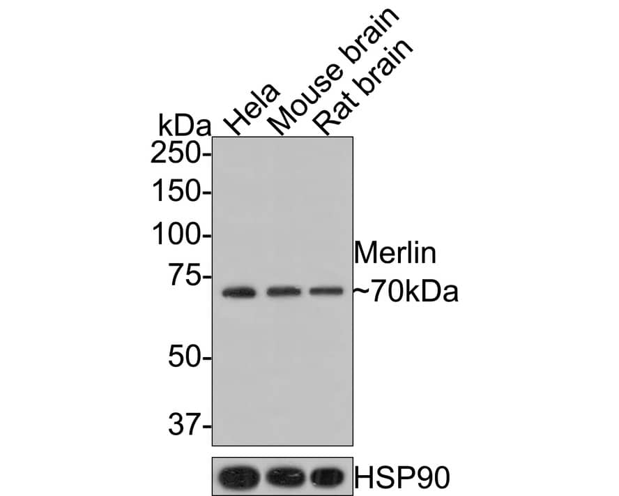 Western Blot: NF2/Merlin Antibody (JE31-02) [NBP3-32589] - Western blot analysis of NF2/Merlin on different lysates with Rabbit anti-NF2/Merlin antibody (NBP3-32589) at 1/500 dilution. Lane 1: Hela cell lysate (10 ug/Lane) Lane 2: Mouse brain tissue lysate (20 ug/Lane) Lane 3: Rat brain tissue lysate (20 ug/Lane) Predicted band size: 70 kDa Observed band size: 70 kDa Exposure time: 2 minutes; 8% SDS-PAGE gel. Proteins were transferred to a PVDF membrane and blocked with 5% NFDM/TBST for 1 hour at room temperature. The primary antibody (NBP3-32589) at 1/500 dilution was used in 5% NFDM/TBST at room temperature for 2 hours. Goat Anti-Rabbit IgG - HRP Secondary Antibody at 1:200,000 dilution was used for 1 hour at room temperature.