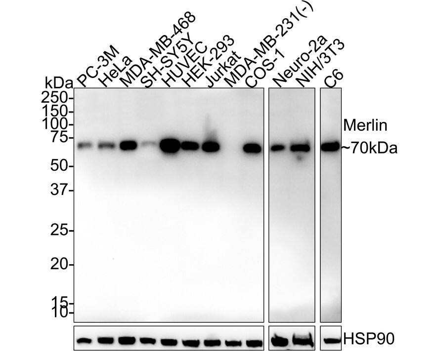 Western blot analysis on different lysates with NBP3-32590 at 1/2,000 dilution. Lane 1: PC-3M cell lysate (20 µg/Lane) Lane 2: HeLa cell lysate (20 µg/Lane) Lane 3: MDA-MB-468 cell lysate (20 µg/Lane) Lane 4: SH-SY5Y cell lysate (20 µg/Lane) Lane 5: HUVEC cell lysate (20 µg/Lane) Lane 6: HEK-293 cell lysate (20 µg/Lane) Lane 7: Jurkat cell lysate (20 µg/Lane) Lane 8: MDA-MB-231 cell lysate (negative) (20 µg/Lane) Lane 9: COS-1 cell lysate (20 µg/Lane) Lane 10: Neuro-2a cell lysate (20 µg/Lane) Lane 11: NIH/3T3 cell lysate (20 µg/Lane) Lane 12: C6 cell lysate (20 µg/Lane) Predicted band size: 70 kDa Observed band size: 70 kDa Exposure time: 1 minute 41 seconds; 4-20% SDS-PAGE gel. Proteins were transferred to a PVDF membrane and blocked with 5% NFDM/TBST for 1 hour at room temperature. NBP3-32590 at 1/2,000 dilution was used in 5% NFDM/TBST at 4℃ overnight. Goat Anti-Rabbit IgG [HRP] Secondary Antibody at 1/50,000 dilution was used for 1 hour at room temperature.