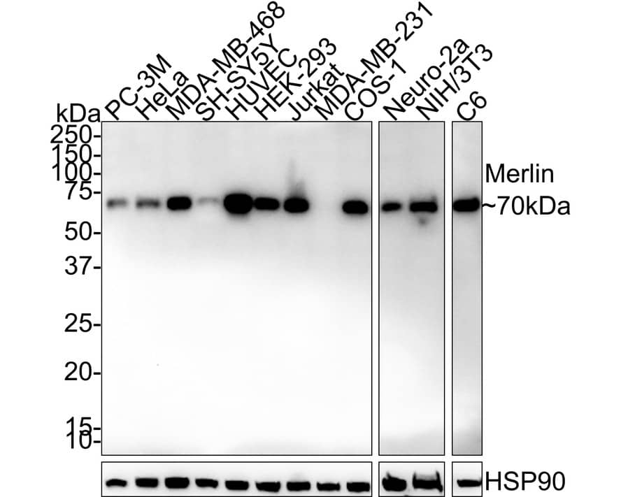 Western Blot: NF2/Merlin Antibody (PSH02-52) [NBP3-32590] - Western blot analysis of NF2/Merlin on different lysates with Rabbit anti-NF2/Merlin antibody (NBP3-32590) at 1/2,000 dilution. Lane 1: PC-3M cell lysate (20 ug/Lane) Lane 2: HeLa cell lysate (20 ug/Lane) Lane 3: MDA-MB-468 cell lysate (20 ug/Lane) Lane 4: SH-SY5Y cell lysate (20 ug/Lane) Lane 5: HUVEC cell lysate (20 ug/Lane) Lane 6: HEK-293 cell lysate (20 ug/Lane) Lane 7: Jurkat cell lysate (20 ug/Lane) Lane 8: MDA-MB-231 cell lysate (negative) (20 ug/Lane) Lane 9: COS-1 cell lysate (20 ug/Lane) Lane 10: Neuro-2a cell lysate (20 ug/Lane) Lane 11: NIH/3T3 cell lysate (20 ug/Lane) Lane 12: C6 cell lysate (20 ug/Lane) Predicted band size: 70 kDa Observed band size: 70 kDa Exposure time: 1 minute 41 seconds; 4-20% SDS-PAGE gel. Proteins were transferred to a PVDF membrane and blocked with 5% NFDM/TBST for 1 hour at room temperature. The primary antibody (NBP3-32590) at 1/2,000 dilution was used in 5% NFDM/TBST at 4  overnight. Goat Anti-Rabbit IgG - HRP Secondary Antibody at 1/50,000 dilution was used for 1 hour at room temperature.