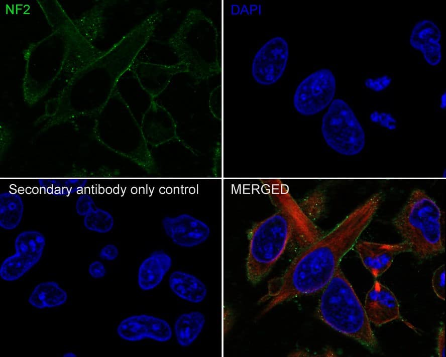 Immunocytochemistry/ Immunofluorescence: NF2/Merlin Antibody (PSH02-52) [NBP3-32590] - Immunocytochemistry analysis of HUVEC cells labeling NF2/Merlin with Rabbit anti-NF2/Merlin antibody (NBP3-32590) at 1/100 dilution. Cells were fixed in 100% precooled methanol for 5 minutes at room temperature, then blocked with 1% BSA in 10% negative goat serum for 1 hour at room temperature. Cells were then incubated with Rabbit anti-NF2/Merlin antibody (NBP3-32590) at 1/100 dilution in 1% BSA in PBST overnight at 4 ℃. Goat Anti-Rabbit IgG H&L (iFluor™ 488) was used as the secondary antibody at 1/1,000 dilution. PBS instead of the primary antibody was used as the secondary antibody only control. Nuclear DNA was labelled in blue with DAPI. Beta tubulin (red) was stained at 1/100 dilution overnight at +4℃. Goat Anti-Mouse IgG H&L (iFluor™ 594) was used as the secondary antibody at 1/1,000 dilution.