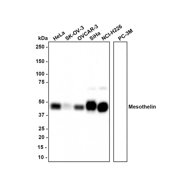 Western blot analysis on different lysates with NBP3-32591 at 1/1,000 dilution. Lane 1: HeLa cell lysate Lane 2: SK-OV-3 cell lysate Lane 3: OVCAR-3 cell lysate Lane 4: SiHa cell lysate Lane 5: NCI-H226 cell lysate Lane 6: PC-3M cell lysate (negative) Lysates/proteins at 20 µg/Lane. Predicted band size: 69 kDa Observed band size: 45 kDa Exposure time: 7 seconds; 4-20% SDS-PAGE gel. Proteins were transferred to a PVDF membrane and blocked with 5% NFDM/TBST for 1 hour at room temperature. NBP3-32591 at 1/1,000 dilution was used in 5% NFDM/TBST at room temperature for 2 hours. Goat Anti-Rabbit IgG [HRP] Secondary Antibody at 1/100,000 dilution was used for 1 hour at room temperature.