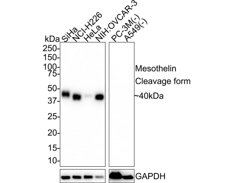 Western blot analysis on different lysates with NBP3-32593 at 1/1,000 dilution. Lane 1: SiHa cell lysate Lane 2: NCI-H226 cell lysate Lane 3: HeLa cell lysate Lane 4: NIH:OVCAR-3 cell lysate Lane 5: PC-3M cell lysate (negative) Lane 6: A549 cell lysate (negative) Lysates/proteins at 20 µg/Lane. Predicted band size: 68 kDa Observed band size: 40 kDa Exposure time: 1 minute 2 seconds; 4-20% SDS-PAGE gel. Proteins were transferred to a PVDF membrane and blocked with 5% NFDM/TBST for 1 hour at room temperature. NBP3-32593 at 1/1,000 dilution was used in 5% NFDM/TBST at room temperature for 2 hours. Goat Anti-Rabbit IgG [HRP] Secondary Antibody at 1/50,000 dilution was used for 1 hour at room temperature.