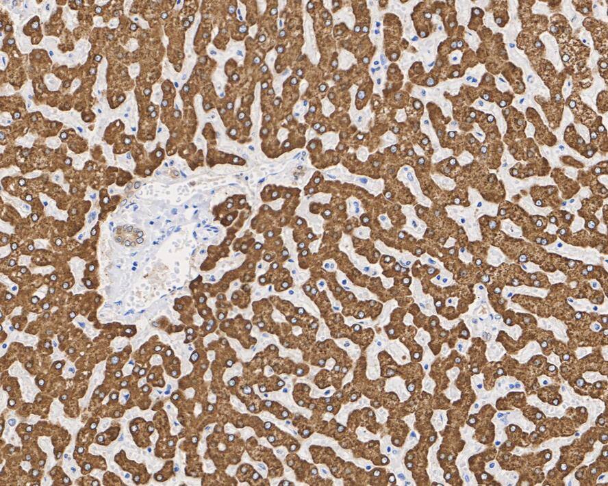 Immunohistochemistry: Microsomal Glutathione S-transferase 1 Antibody (14H2-R) [NBP3-32594] - Immunohistochemical analysis of paraffin-embedded human liver tissue with Mouse anti-Microsomal Glutathione S-transferase 1 antibody (NBP3-32594) at 1/1,000 dilution. The section was pre-treated using heat mediated antigen retrieval with Tris-EDTA buffer (pH 9.0) for 20 minutes. The tissues were blocked in 1% BSA for 20 minutes at room temperature, washed with ddH2O and PBS, and then probed with the primary antibody (NBP3-32594) at 1/1,000 dilution for 1 hour at room temperature. The detection was performed using an HRP conjugated compact polymer system. DAB was used as the chromogen. Tissues were counterstained with hematoxylin and mounted with DPX.