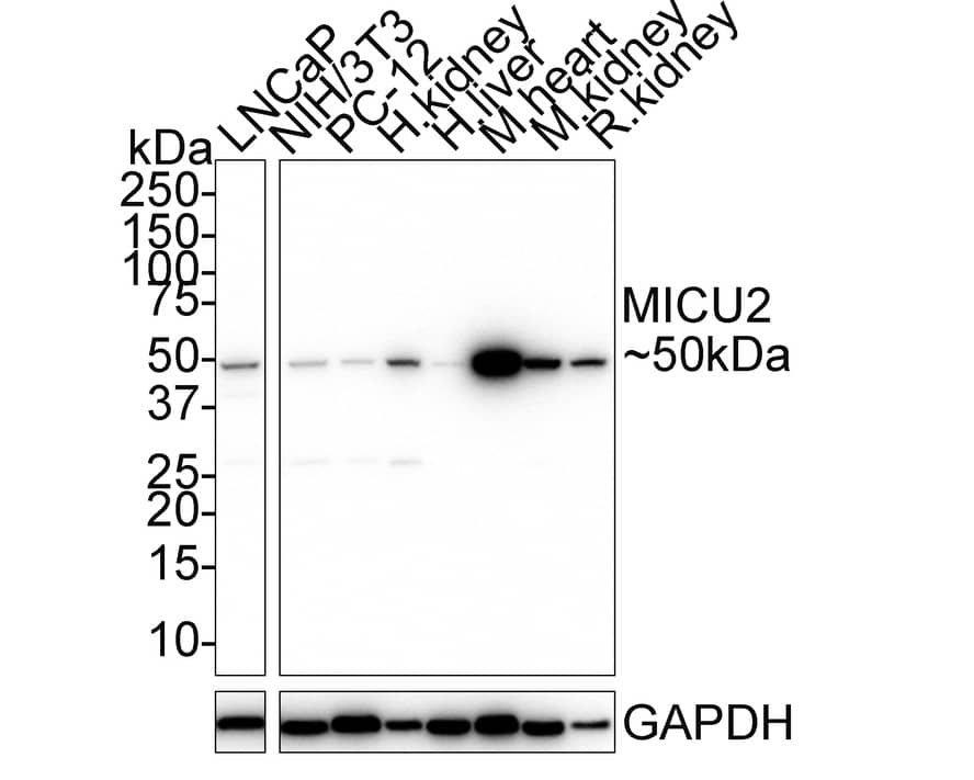 Western Blot EFHA1 Antibody (PSH01-84)