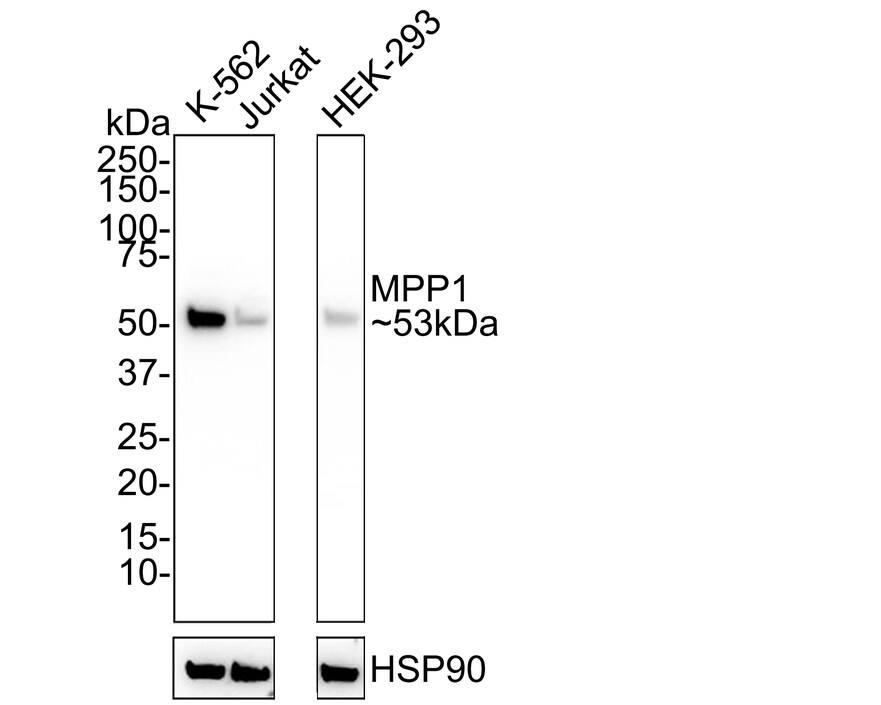 Western Blot MPP1 Antibody (PSH02-69)
