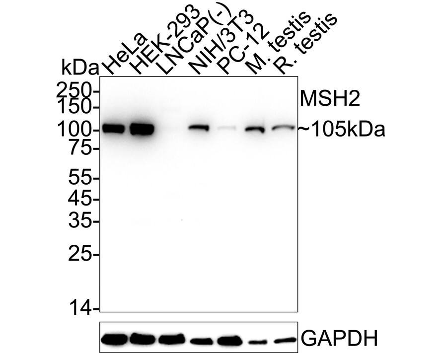 Western blot analysis on different lysates with NBP3-32604 at 1/2,000 dilution. Lane 1: HeLa cell lysate Lane 2: HEK-293 cell lysate Lane 3: LNCaP cell lysate (negative) Lane 4: NIH/3T3 cell lysate Lane 5: PC-12 cell lysate Lane 6: Mouse testis tissue lysate Lane 7: Rat testis tissue lysate Lysates/proteins at 20 µg/Lane. Predicted band size: 105 kDa Observed band size: 105 kDa Exposure time: 10 seconds;  4-20% SDS-PAGE gel. Proteins were transferred to a PVDF membrane and blocked with 5% NFDM/TBST for 1 hour at room temperature. NBP3-32604 at 1/2,000 dilution was used in 5% NFDM/TBST at 4℃ overnight. Goat anti-Mouse IgG [HRP] at 1/50,000 dilution was used for 1 hour at room temperature.