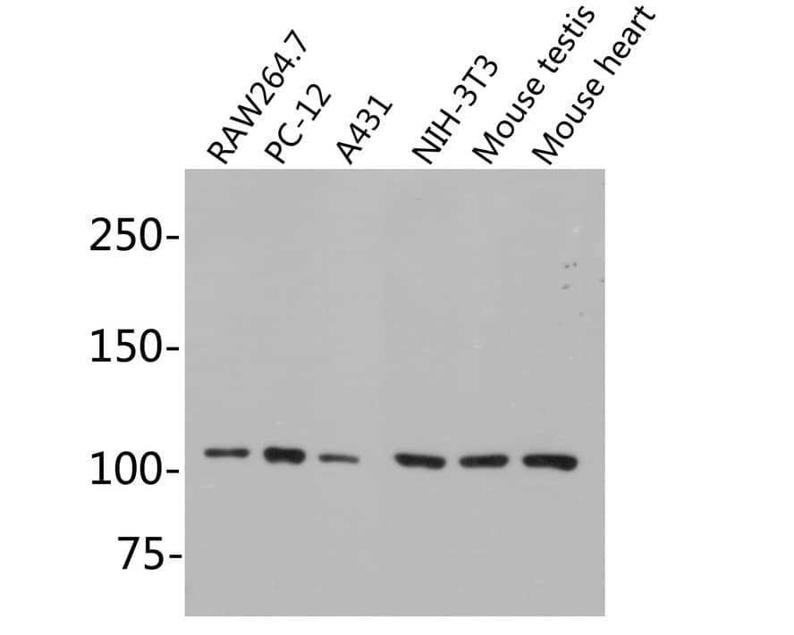 Western Blot: MSH2 Antibody (10G3-R) [NBP3-32604] - Western blot analysis of MSH2 on different lysates with Mouse anti-MSH2 antibody (NBP3-32604) at 1/5,000 dilution. Lane 1: RAW264.7 cell lysate, 10 ug/Lane Lane 2: PC-12 cell lysate, 10 ug/Lane Lane 3: A431 cell lysate, 10 ug/Lane Lane 4: NIH-3T3 cell lysate, 10 ug/Lane Lane 5: Mouse testis tissue lysate, 20 ug/Lane Lane 6: Mouse heart tissue lysate, 20 ug/Lane Predicted band size: 105 kDa Observed band size: 105 kDa Exposure time: 2 minutes; 5% SDS-PAGE gel. Proteins were transferred to a PVDF membrane and blocked with 5% NFDM/TBST for 1 hour at room temperature. The primary antibody (NBP3-32604) at 1/5,000 dilution was used in 5% NFDM/TBST at room temperature for 2 hours. Goat Anti-Mouse IgG - HRP Secondary Antibody at 1:150,000 dilution was used for 1 hour at room temperature.