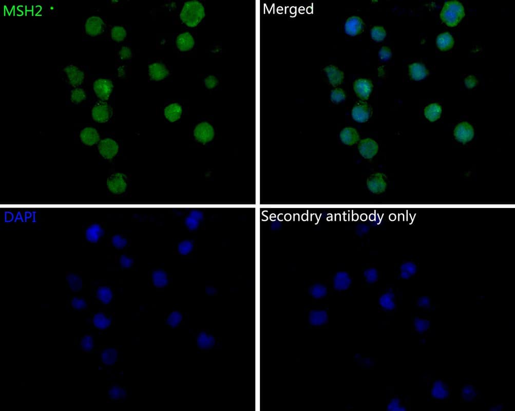 Immunocytochemistry/ Immunofluorescence: MSH2 Antibody (10G3-R) [NBP3-32604] - Immunocytochemistry analysis of Daudi cells labeling MSH2 with Mouse anti-MSH2 antibody (NBP3-32604) at 1/200 dilution. Cells were fixed in 4% paraformaldehyde for 10 minutes at 37 ℃, permeabilized with 0.05% Triton X-100 in PBS for 20 minutes, and then blocked with 2% negative goat serum for 30 minutes at room temperature. Cells were then incubated with Rabbit anti-MSH2 antibody (NBP3-32604) at 1/200 dilution in 2% negative goat serum overnight at 4 ℃. Goat Anti-Mouse IgG H&L (iFluor™ 488) was used as the secondary antibody at 1/1,000 dilution. PBS instead of the primary antibody was used as the secondary antibody only control. Nuclear DNA was labelled in blue with DAPI.