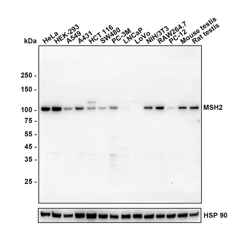 Western blot analysis on different lysates with NBP3-32605 at 1/1,000 dilution. Lane 1: HeLa cell lysate (15 µg/Lane) Lane 2: HEK-293 cell lysate (15 µg/Lane) Lane 3: A549 cell lysate (15 µg/Lane) Lane 4: A431 cell lysate (15 µg/Lane) Lane 5: HCT 116 cell lysate (15 µg/Lane) Lane 6: SW480 cell lysate (15 µg/Lane) Lane 7: PC-3M cell lysate (15 µg/Lane) Lane 8: LNCaP cell lysate (negative) (15 µg/Lane) Lane 9: LoVo cell lysate (negative) (15 µg/Lane) Lane 10: NIH/3T3 cell lysate (15 µg/Lane) Lane 11: RAW264.7 cell lysate (15 µg/Lane) Lane 12: PC-12 cell lysate (15 µg/Lane) Lane 13: Mouse testis tissue lysate (25 µg/Lane) Lane 14: Rat testis tissue lysate (25 µg/Lane) Predicted band size: 105 kDa Observed band size: 105 kDa Exposure time: 1 minute 2 seconds; 4-20% SDS-PAGE gel. Proteins were transferred to a PVDF membrane and blocked with 5% NFDM/TBST for 1 hour at room temperature. NBP3-32605 at 1/1,000 dilution was used in 5% NFDM/TBST at 4℃ overnight. Goat anti-Mouse IgG [HRP] at 1/50,000 dilution was used for 1 hour at room temperature.