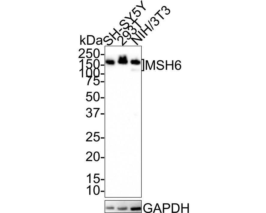 Western blot analysis on different lysates with NBP3-32606 at 1/1,000 dilution. Lane 1: SH-SY5Y cell lysate Lane 2: 293T cell lysate Lane 3: NIH/3T3 cell lysate Lysates/proteins at 20 µg/Lane. Predicted band size: 153 kDa Observed band size: 180/140 kDa Exposure time: 15 seconds; 4-20% SDS-PAGE gel. Proteins were transferred to a PVDF membrane and blocked with 5% NFDM/TBST for 1 hour at room temperature. NBP3-32606 at 1/1,000 dilution was used in 5% NFDM/TBST at room temperature for 2 hours. Goat anti-Mouse IgG [HRP] at 1/100,000 dilution was used for 1 hour at room temperature.