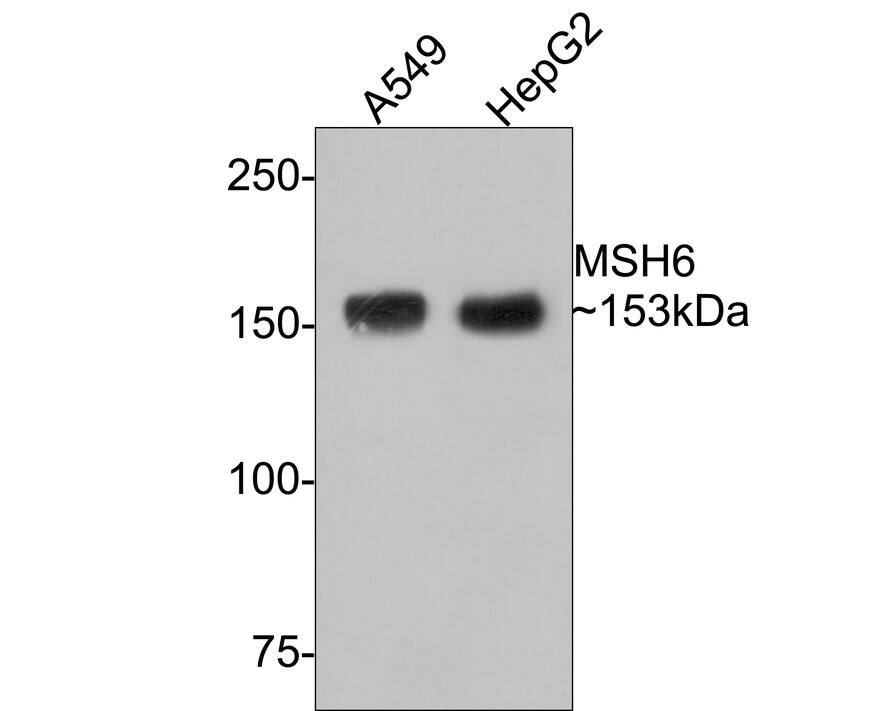 Western blot analysis on different lysates with NBP3-32607 at 1/1,000 dilution. Lane 1: A549 cell lysate Lane 2: HepG2 cell lysate Lysates/proteins at 10 µg/Lane. Predicted band size: 153 kDa Observed band size: 153 kDa Exposure time: 2 minutes; 6% SDS-PAGE gel. Proteins were transferred to a PVDF membrane and blocked with 5% NFDM/TBST for 1 hour at room temperature. NBP3-32607 at 1/1,000 dilution was used in 5% NFDM/TBST at room temperature for 2 hours. Goat Anti-Rabbit IgG [HRP] Secondary Antibody at 1:300,000 dilution was used for 1 hour at room temperature.