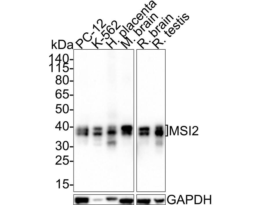Western blot analysis on different lysates with NBP3-32608 at 1/1,000 dilution. Lane 1: PC-12 cell lysate (20 µg/Lane) Lane 2: K-562 cell lysate (20 µg/Lane) Lane 3: Human placenta tissue lysate (40 µg/Lane) Lane 4: Mouse brain tissue lysate (40 µg/Lane) Lane 5: Rat brain tissue lysate (40 µg/Lane) Lane 6: Rat testis tissue lysate (40 µg/Lane) Predicted band size: 35 kDa Observed band size: 35/37 kDa Exposure time: 3 minutes; 4-20% SDS-PAGE gel. Proteins were transferred to a PVDF membrane and blocked with 5% NFDM/TBST for 1 hour at room temperature. NBP3-32608 at 1/1,000 dilution was used in 5% NFDM/TBST at room temperature for 2 hours. Goat Anti-Rabbit IgG [HRP] Secondary Antibody at 1:200,000 dilution was used for 1 hour at room temperature.