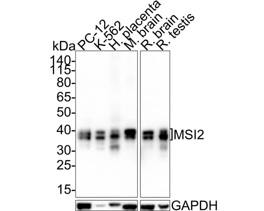 Western Blot: Musashi-2 Antibody (PSH01-17) [NBP3-32608] - Western blot analysis of Musashi-2 on different lysates with Rabbit anti-Musashi-2 antibody (NBP3-32608) at 1/1,000 dilution. Lane 1: PC-12 cell lysate (20 ug/Lane) Lane 2: K-562 cell lysate (20 ug/Lane) Lane 3: Human placenta tissue lysate (40 ug/Lane) Lane 4: Mouse brain tissue lysate (40 ug/Lane) Lane 5: Rat brain tissue lysate (40 ug/Lane) Lane 6: Rat testis tissue lysate (40 ug/Lane) Predicted band size: 35 kDa Observed band size: 35/37 kDa Exposure time: 3 minutes; 4-20% SDS-PAGE gel. Proteins were transferred to a PVDF membrane and blocked with 5% NFDM/TBST for 1 hour at room temperature. The primary antibody (NBP3-32608) at 1/1,000 dilution was used in 5% NFDM/TBST at room temperature for 2 hours. Goat Anti-Rabbit IgG - HRP Secondary Antibody at 1:200,000 dilution was used for 1 hour at room temperature.