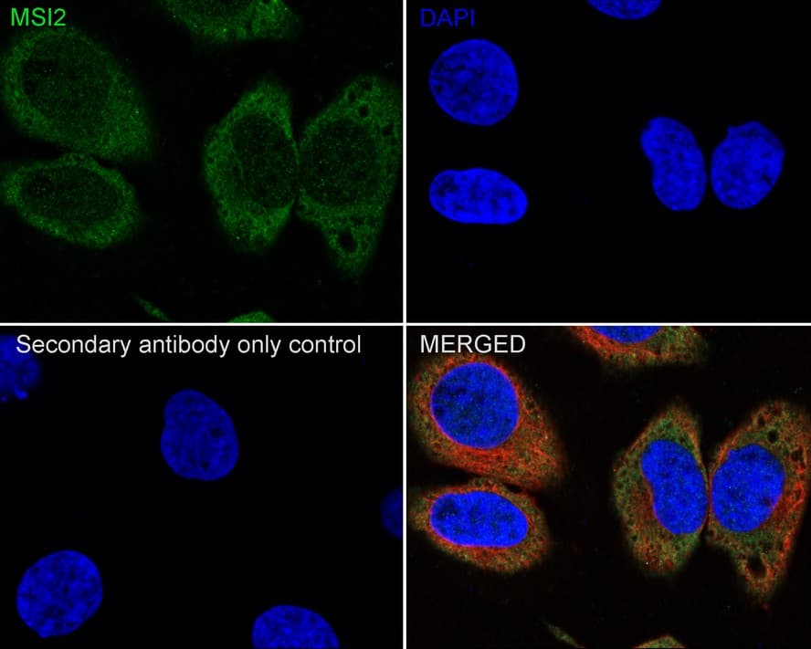 Immunocytochemistry/ Immunofluorescence: Musashi-2 Antibody (PSH01-17) [NBP3-32608] - Immunocytochemistry analysis of HeLa cells labeling Musashi-2 with Rabbit anti-Musashi-2 antibody (NBP3-32608) at 1/100 dilution. Cells were fixed in 4% paraformaldehyde for 20 minutes at room temperature, permeabilized with 0.1% Triton X-100 in PBS for 5 minutes at room temperature, then blocked with 1% BSA in 10% negative goat serum for 1 hour at room temperature. Cells were then incubated with Rabbit anti-Musashi-2 antibody (NBP3-32608) at 1/100 dilution in 1% BSA in PBST overnight at 4 ℃. Goat Anti-Rabbit IgG H&L (iFluor™ 488) was used as the secondary antibody at 1/1,000 dilution. PBS instead of the primary antibody was used as the secondary antibody only control. Nuclear DNA was labelled in blue with DAPI. Beta tubulin (red) was stained at 1/100 dilution overnight at +4℃. Goat Anti-Mouse IgG H&L (iFluor™ 594) was used as the secondary antibody at 1/1,000 dilution.