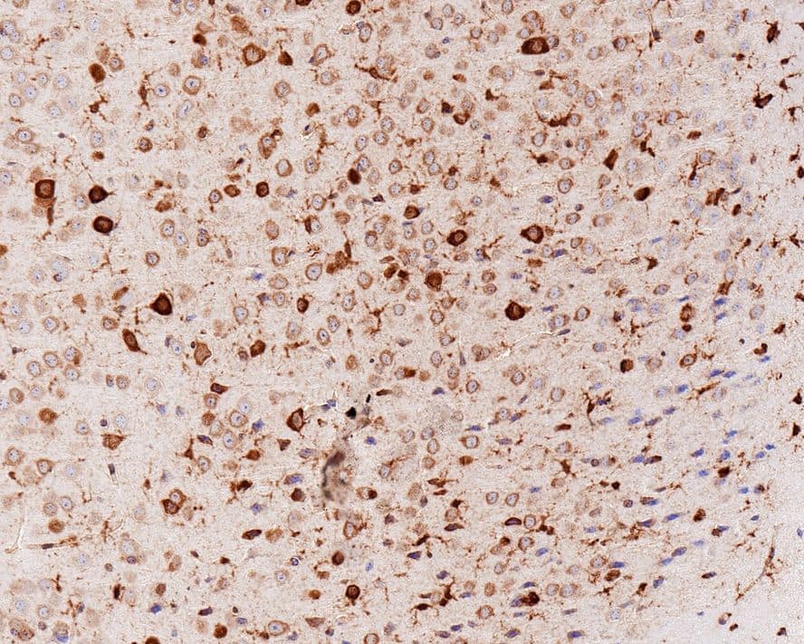 Immunohistochemistry: Musashi-2 Antibody (PSH01-17) [NBP3-32608] - Immunohistochemical analysis of paraffin-embedded mouse brain tissue with Rabbit anti-Musashi-2 antibody (NBP3-32608) at 1/1,000 dilution. The section was pre-treated using heat mediated antigen retrieval with Tris-EDTA buffer (pH 9.0) for 20 minutes. The tissues were blocked in 1% BSA for 20 minutes at room temperature, washed with ddH2O and PBS, and then probed with the primary antibody (NBP3-32608) at 1/1,000 dilution for 1 hour at room temperature. The detection was performed using an HRP conjugated compact polymer system. DAB was used as the chromogen. Tissues were counterstained with hematoxylin and mounted with DPX.