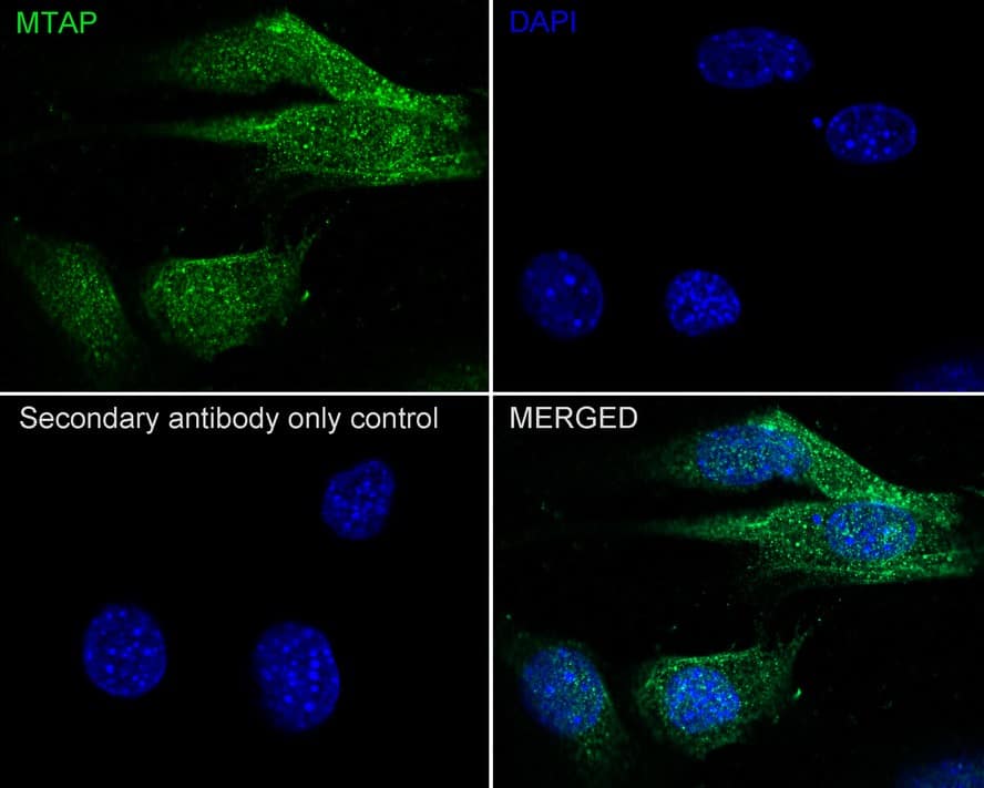 Immunocytochemistry/ Immunofluorescence: MTAP Antibody (JE63-74) [NBP3-32610] - Immunocytochemistry analysis of NIH/3T3 cells labeling MTAP with Rabbit anti-MTAP antibody (NBP3-32610) at 1/100 dilution. Cells were fixed in 4% paraformaldehyde for 20 minutes at room temperature, permeabilized with 0.1% Triton X-100 in PBS for 5 minutes at room temperature, then blocked with 1% BSA in 10% negative goat serum for 1 hour at room temperature. Cells were then incubated with Rabbit anti-MTAP antibody (NBP3-32610) at 1/100 dilution in 1% BSA in PBST overnight at 4 ℃. Goat Anti-Rabbit IgG H&L (iFluor™ 488) was used as the secondary antibody at 1/1,000 dilution. PBS instead of the primary antibody was used as the secondary antibody only control. Nuclear DNA was labelled in blue with DAPI.