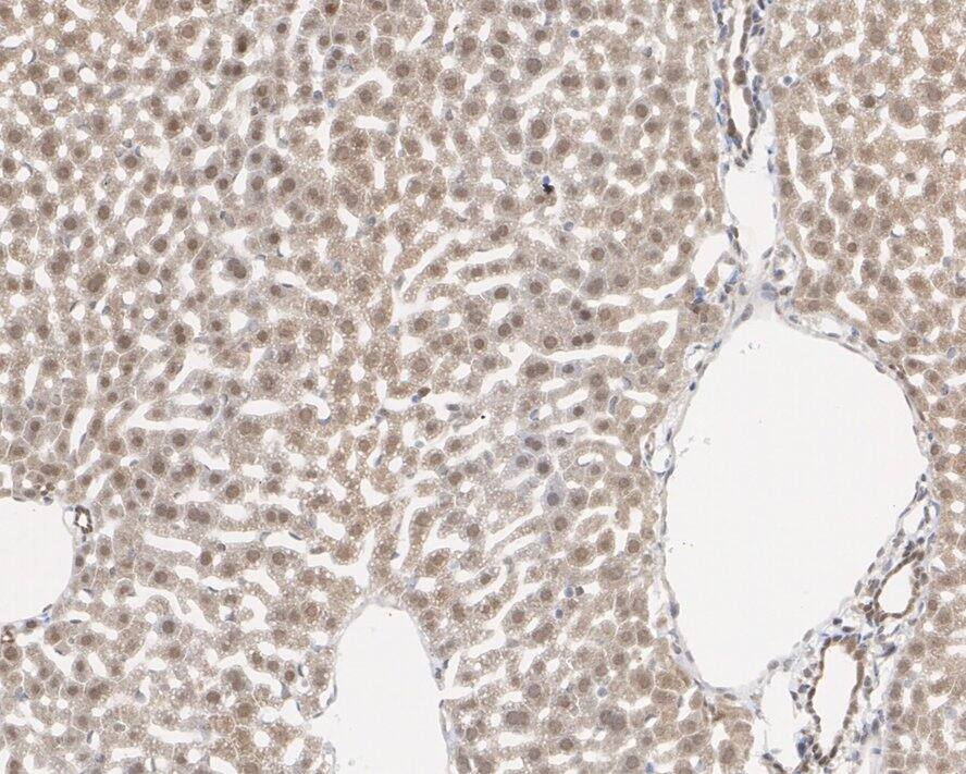 Immunohistochemistry: MTAP Antibody (JE63-74) [NBP3-32610] - Immunohistochemical analysis of paraffin-embedded mouse liver tissue with Rabbit anti-MTAP antibody (NBP3-32610) at 1/500 dilution. The section was pre-treated using heat mediated antigen retrieval with sodium citrate buffer (pH 6.0) for 2 minutes. The tissues were blocked in 1% BSA for 20 minutes at room temperature, washed with ddH2O and PBS, and then probed with the primary antibody (NBP3-32610) at 1/500 dilution for 1 hour at room temperature. The detection was performed using an HRP conjugated compact polymer system. DAB was used as the chromogen. Tissues were counterstained with hematoxylin and mounted with DPX.