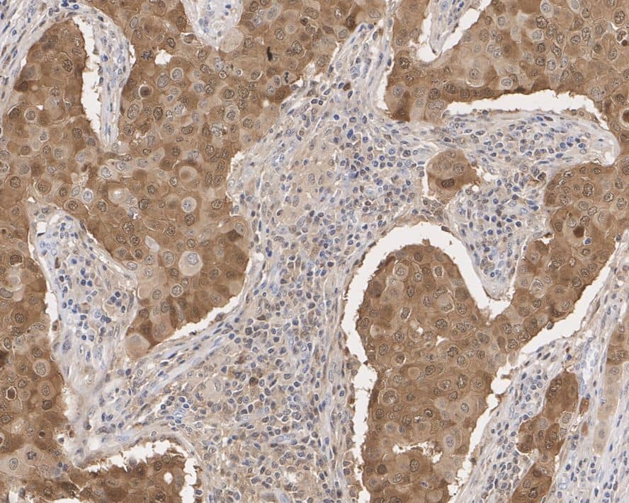 Immunohistochemistry MTH1 Antibody (PSH02-40)