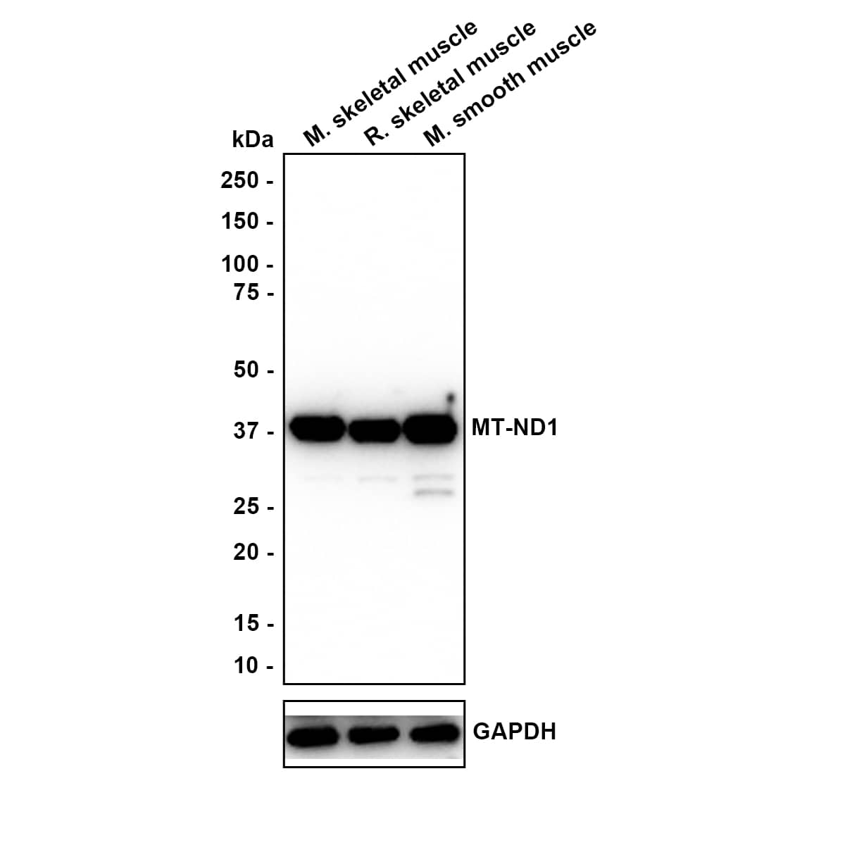Western Blot MT-ND1 Antibody (JE34-93)