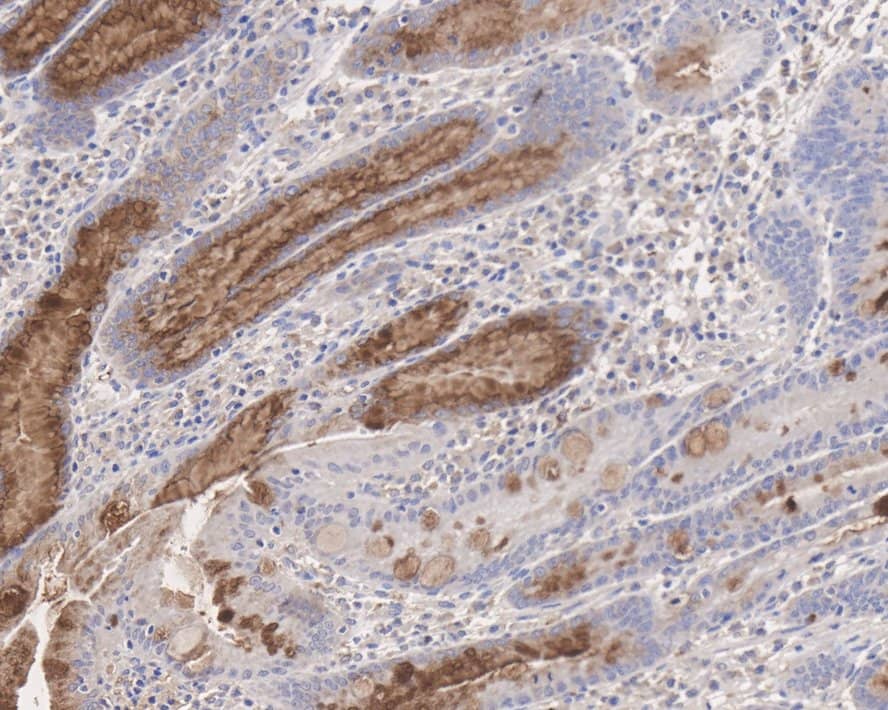 Immunohistochemistry: MUC5AC Antibody (A10G5-R) [NBP3-32615] - Immunohistochemical analysis of paraffin-embedded human stomach tissue with Mouse anti-MUC5AC antibody (NBP3-32615) at 1/1,000 dilution. The section was pre-treated using heat mediated antigen retrieval with Tris-EDTA buffer (pH 9.0) for 20 minutes. The tissues were blocked in 1% BSA for 20 minutes at room temperature, washed with ddH2O and PBS, and then probed with the primary antibody (NBP3-32615) at 1/1,000 dilution for 1 hour at room temperature. The detection was performed using an HRP conjugated compact polymer system. DAB was used as the chromogen. Tissues were counterstained with hematoxylin and mounted with DPX.