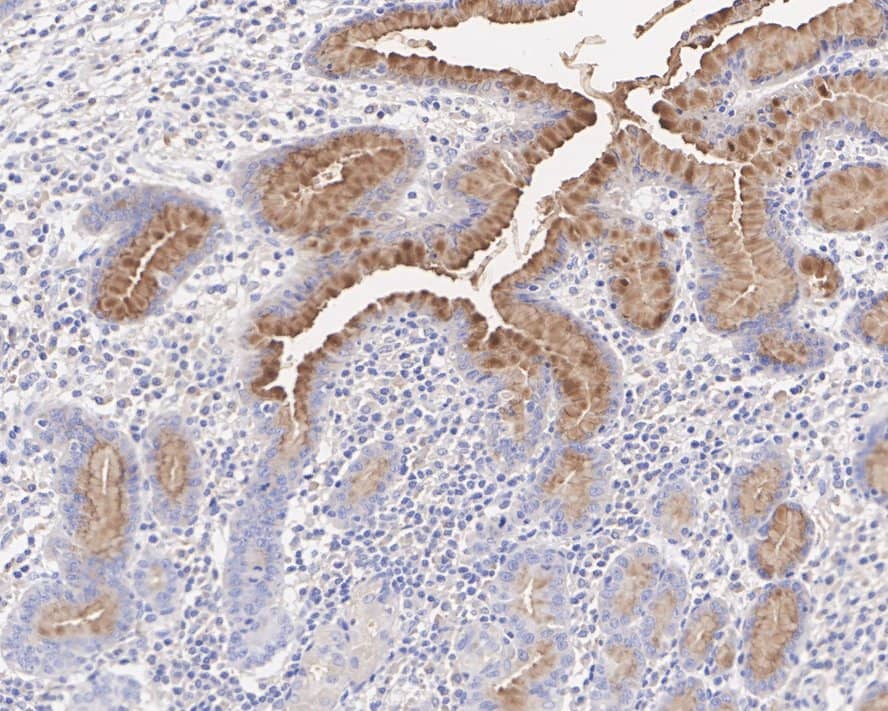Immunohistochemistry: MUC5AC Antibody (A10G6-R) [NBP3-32616] - Immunohistochemical analysis of paraffin-embedded human stomach tissue with Mouse anti-MUC5AC antibody (NBP3-32616) at 1/1,000 dilution. The section was pre-treated using heat mediated antigen retrieval with Tris-EDTA buffer (pH 9.0) for 20 minutes. The tissues were blocked in 1% BSA for 20 minutes at room temperature, washed with ddH2O and PBS, and then probed with the primary antibody (NBP3-32616) at 1/1,000 dilution for 1 hour at room temperature. The detection was performed using an HRP conjugated compact polymer system. DAB was used as the chromogen. Tissues were counterstained with hematoxylin and mounted with DPX.