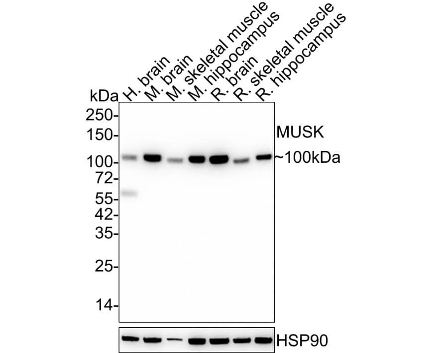 Western blot analysis on different lysates with NBP3-32620 at 1/2,000 dilution. Lane 1: Human brain tissue lysate Lane 2: Mouse brain tissue lysate Lane 3: Mouse skeletal muscle tissue lysate Lane 4: Mouse hippocampus tissue lysate Lane 5: Rat brain tissue lysate Lane 6: Rat skeletal muscle tissue lysate Lane 7: Rat hippocampus tissue lysate Lysates/proteins at 30 µg/Lane. Predicted band size: 97 kDa Observed band size: 100 kDa Exposure time: 50 seconds; 4-20% SDS-PAGE gel. Proteins were transferred to a PVDF membrane and blocked with 5% NFDM/TBST for 1 hour at room temperature. NBP3-32620 at 1/2,000 dilution was used in 5% NFDM/TBST at 4℃ overnight. Goat Anti-Rabbit IgG [HRP] Secondary Antibody at 1/50,000 dilution was used for 1 hour at room temperature.