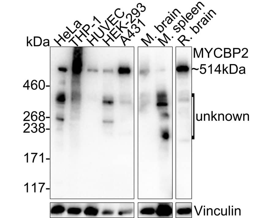 Western blot analysis on different lysates with NBP3-32621 at 1/2,000 dilution. Lane 1: HeLa cell lysate (20 µg/Lane) Lane 2: THP-1 cell lysate (20 µg/Lane) Lane 3: HUVEC cell lysate (20 µg/Lane) Lane 4: HEK-293 cell lysate (20 µg/Lane) Lane 5: A431 cell lysate (20 µg/Lane) Lane 6: Mouse brain tissue lysate (40 µg/Lane) Lane 7: Mouse spleen tissue lysate (40 µg/Lane) Lane 8: Rat brain tissue lysate (40 µg/Lane) Lysates/proteins at 10 µg/Lane. Predicted band size: 514 kDa Observed band size: 514 kDa Exposure time: 1 minute; 3-8% SDS-PAGE gel. Proteins were transferred to a PVDF membrane and blocked with 5% NFDM/TBST for 1 hour at room temperature. NBP3-32621 at 1/2,000 dilution was used in 5% NFDM/TBST at 4℃ overnight. Goat Anti-Rabbit IgG [HRP] Secondary Antibody at 1/50,000 dilution was used for 1 hour at room temperature.