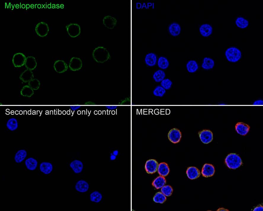 Immunocytochemistry/ Immunofluorescence: Myeloperoxidase/MPO Antibody (A1F2-R) [NBP3-32623] - Immunocytochemistry analysis of HL-60 cells labeling Myeloperoxidase/MPO with Mouse anti-Myeloperoxidase/MPO antibody (NBP3-32623) at 1/100 dilution. Cells were fixed in 4% paraformaldehyde for 20 minutes at room temperature, permeabilized with 0.1% Triton X-100 in PBS for 5 minutes at room temperature, then blocked with 1% BSA in 10% negative goat serum for 1 hour at room temperature. Cells were then incubated with Mouse anti-Myeloperoxidase/MPO antibody (NBP3-32623) at 1/100 dilution in 1% BSA in PBST overnight at 4 ℃. Goat Anti-Mouse IgG H&L (iFluor™ 488) was used as the secondary antibody at 1/1,000 dilution. PBS instead of the primary antibody was used as the secondary antibody only control. Nuclear DNA was labelled in blue with DAPI. beta Tubulin (red) was stained at 1/100 dilution overnight at +4℃. Goat Anti-Rabbit IgG H&L (iFluor™ 594) were used as the secondary antibody at 1/1,000 dilution.