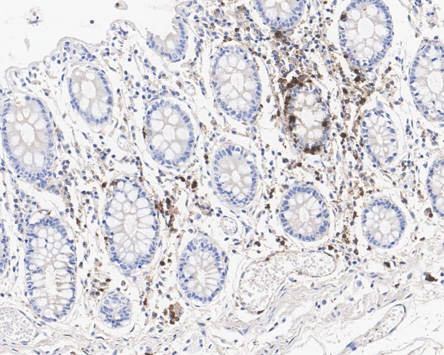 Immunohistochemistry: Myeloperoxidase/MPO Antibody (A1F2-R) [NBP3-32623] - Immunohistochemical analysis of paraffin-embedded human colon tissue with Mouse anti-Myeloperoxidase/MPO antibody (NBP3-32623) at 1/10,000 dilution. The section was pre-treated using heat mediated antigen retrieval with Tris-EDTA buffer (pH 9.0) for 20 minutes. The tissues were blocked in 1% BSA for 20 minutes at room temperature, washed with ddH2O and PBS, and then probed with the primary antibody (NBP3-32623) at 1/10,000 dilution for 1 hour at room temperature. The detection was performed using an HRP conjugated compact polymer system. DAB was used as the chromogen. Tissues were counterstained with hematoxylin and mounted with DPX.