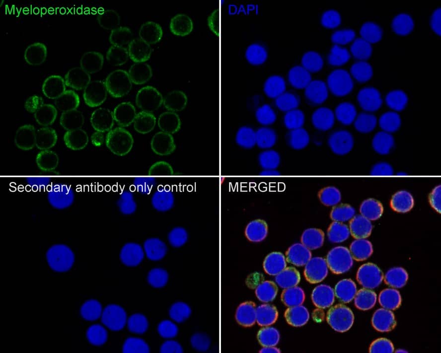 Immunocytochemistry/ Immunofluorescence: Myeloperoxidase/MPO Antibody (PD00-20) [NBP3-32624] - Immunocytochemistry analysis of Jurkat cells labeling Myeloperoxidase/MPO with Rabbit anti-Myeloperoxidase/MPO/MPO antibody (NBP3-32624) at 1/100 dilution. Cells were fixed in 80% precooled methanol for 5 minutes at room temperature, then blocked with 1% BSA in 10% negative goat serum for 1 hour at room temperature. Cells were then incubated with Rabbit anti-Myeloperoxidase/MPO antibody (NBP3-32624) at 1/100 dilution in 1% BSA in PBST overnight at 4 ℃. Goat Anti-Rabbit IgG H&L (iFluor™ 488) was used as the secondary antibody at 1/1,000 dilution. PBS instead of the primary antibody was used as the secondary antibody only control. Nuclear DNA was labelled in blue with DAPI. Beta tubulin (red) was stained at 1/100 dilution overnight at +4℃. Goat Anti-Mouse IgG H&L (iFluor™ 594) was used as the secondary antibody at 1/1,000 dilution.