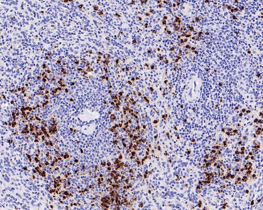 Immunohistochemistry: Myeloperoxidase/MPO Antibody (PD00-20) [NBP3-32624] - Immunohistochemical analysis of paraffin-embedded human spleen tissue with Rabbit anti-Myeloperoxidase/MPO antibody (NBP3-32624) at 1/1,000 dilution. The section was pre-treated using heat mediated antigen retrieval with Tris-EDTA buffer (pH 9.0) for 20 minutes. The tissues were blocked in 1% BSA for 20 minutes at room temperature, washed with ddH2O and PBS, and then probed with the primary antibody (NBP3-32624) at 1/1,000 dilution for 1 hour at room temperature. The detection was performed using an HRP conjugated compact polymer system. DAB was used as the chromogen. Tissues were counterstained with hematoxylin and mounted with DPX.