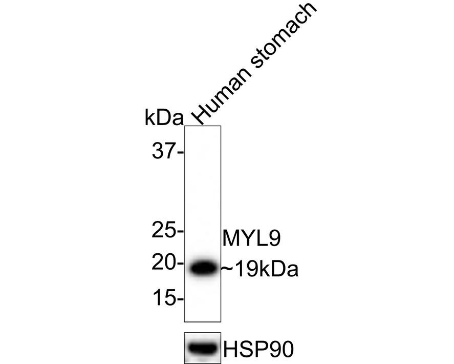 Western blot analysis of  human stomach tissue lysates with NBP3-32626 at 1/1,000 dilution. Lysates/proteins at 40 µg/Lane. Predicted band size: 20 kDa Observed band size: 19 kDa Exposure time: 1 minutes; 4-20% SDS-PAGE gel. Proteins were transferred to a PVDF membrane and blocked with 5% NFDM/TBST for 1 hour at room temperature. NBP3-32626 at 1/1,000 dilution was used in 5% NFDM/TBST at room temperature for 2 hours. Goat Anti-Rabbit IgG [HRP] Secondary Antibody at 1:100,000 dilution was used for 1 hour at room temperature.
