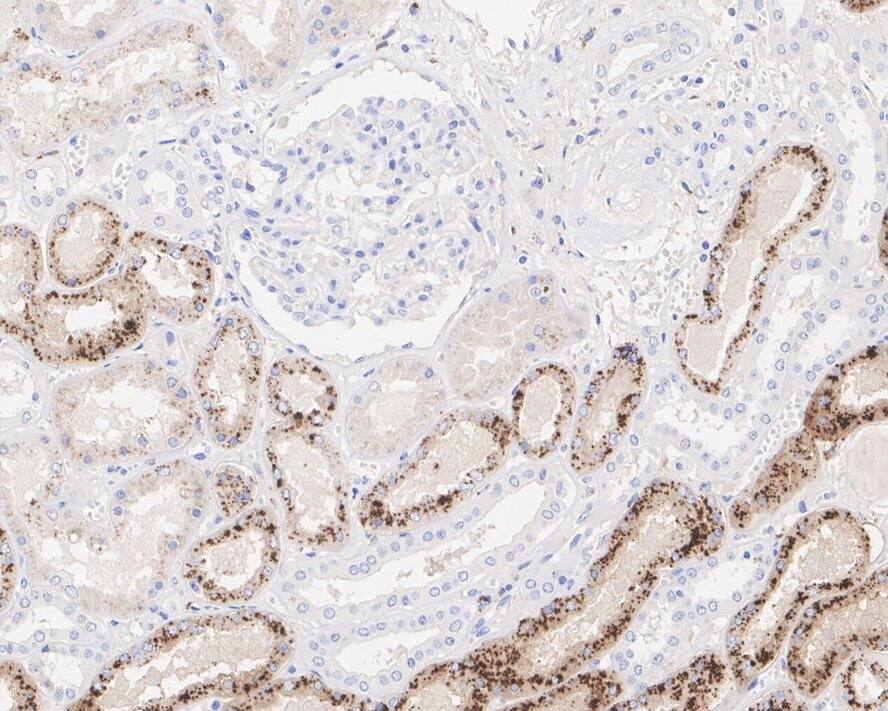 Immunohistochemistry: Napsin A Antibody (A9C1-R) [NBP3-32633] - Immunohistochemical analysis of paraffin-embedded human kidney tissue with Mouse anti-Napsin A antibody (NBP3-32633) at 1/2,000 dilution. The section was pre-treated using heat mediated antigen retrieval with Tris-EDTA buffer (pH 9.0) for 20 minutes. The tissues were blocked in 1% BSA for 20 minutes at room temperature, washed with ddH2O and PBS, and then probed with the primary antibody (NBP3-32633) at 1/2,000 dilution for 1 hour at room temperature. The detection was performed using an HRP conjugated compact polymer system. DAB was used as the chromogen. Tissues were counterstained with hematoxylin and mounted with DPX.