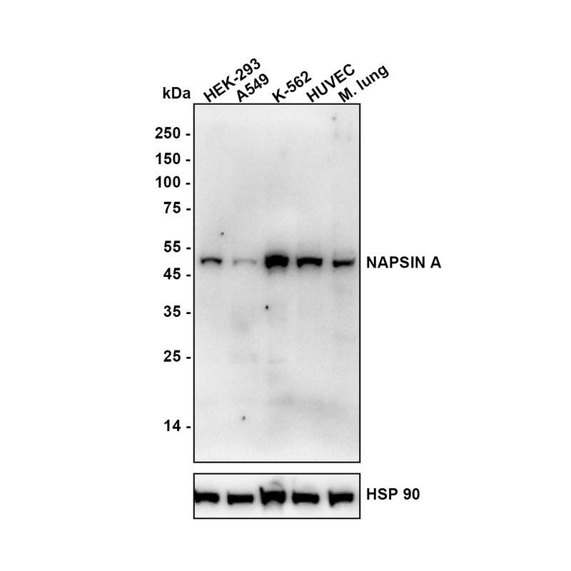 Western blot analysis on different lysates with NBP3-32634 at 1/2,000 dilution. Lane 1: HEK-293 (Human embryonic kidney cell) Lane 2: A549 (Human lung adenocarcinoma cell) Lane 3: K-562 (Human chronic myelogenous leukemia cell) Lane 4: HUVEC (Human umbilical vein endothelial cell) Lane 5: Mouse lung cell lysate 20 µg/Lane. tissue lysate 40 µg/Lane. Exposure time: 3 minutes Blocking: 5% NFDM/TBST, 1 hour at room temperature Primary antibody: NBP3-32634, 1/2,000 in primary antibody dilution buffer, overnight at 4 ℃ Secondary antibody: Goat Anti-Rabbit IgG [HRP] Secondary Antibody, 1/50,000 in 5% NFDM/TBST, 1 hour at room temperature Predicted band size: 45.4 kDa Observed band size: 45.4 kDa