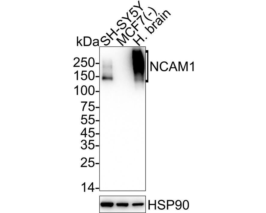 Western blot analysis on different lysates with NBP3-32635 at 1/2,000 dilution. Lane 1: SH-SY5Y cell lysate Lane 2: MCF7 cell lysate (negative) Lane 3: Human brain tissue lysate Lysates/proteins at 20 µg/Lane. Predicted band size: 95 kDa Observed band size: 140-250 kDa Exposure time: 10 seconds;  4-20% SDS-PAGE gel. Proteins were transferred to a PVDF membrane and blocked with 5% NFDM/TBST for 1 hour at room temperature. NBP3-32635 at 1/2,000 dilution was used in 5% NFDM/TBST at 4℃ overnight. Goat anti-Mouse IgG [HRP] at 1/50,000 dilution was used for 1 hour at room temperature.
