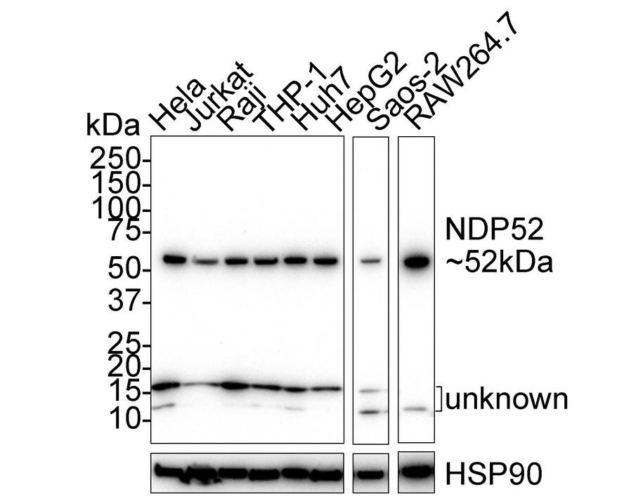 Western Blot: NDP52 Antibody (PSH02-33) [NBP3-32636] - Western blot analysis of NDP52 on different lysates with Rabbit anti-NDP52 antibody (NBP3-32636) at 1/1,000 dilution. Lane 1: HeLa cell lysate Lane 2: Jurkat cell lysate Lane 3: Raji cell lysate Lane 4: THP-1 cell lysate Lane 5: Huh7 cell lysate Lane 6: HepG2 cell lysate Lane 7: Saos-2 cell lysate Lane 8: RAW264.7 cell lysate Lysates/proteins at 30 ug/Lane. Predicted band size: 52 kDa Observed band size: 52 kDa Exposure time: 3 minutes 30 seconds; 4-20% SDS-PAGE gel. Proteins were transferred to a PVDF membrane and blocked with 5% NFDM/TBST for 1 hour at room temperature. The primary antibody (NBP3-32636) at 1/1,000 dilution was used in 5% NFDM/TBST at room temperature for 2 hours. Goat Anti-Rabbit IgG - HRP Secondary Antibody at 1/50,000 dilution was used for 1 hour at room temperature.