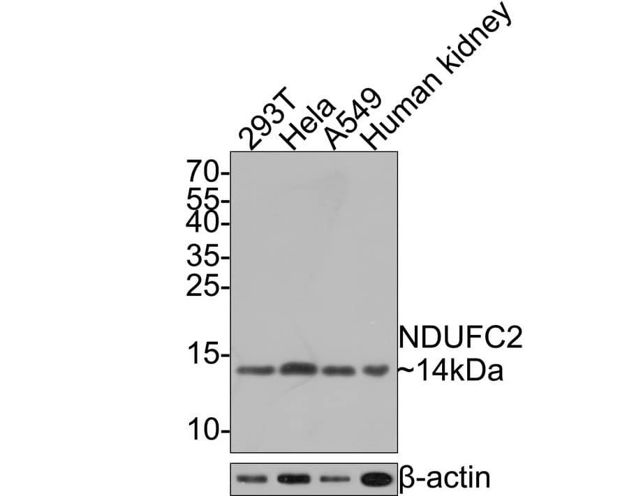 Western Blot: NDUFC2 Antibody (JE65-31) [NBP3-32637] - Western blot analysis of NDUFC2 on different lysates with Rabbit anti-NDUFC2 antibody (NBP3-32637) at 1/500 dilution. Lane 1: 293T cell lysate Lane 2: Hela cell lysate Lane 3: A549 cell lysate Lane 4: Human kidney tissue lysate (20 ug/Lane) Lysates/proteins at 10 ug/Lane. Predicted band size: 14 kDa Observed band size: 14 kDa Exposure time: 1 minute; 15% SDS-PAGE gel. Proteins were transferred to a PVDF membrane and blocked with 5% NFDM/TBST for 1 hour at room temperature. The primary antibody (NBP3-32637) at 1/500 dilution was used in 5% NFDM/TBST at room temperature for 2 hours. Goat Anti-Rabbit IgG - HRP Secondary Antibody at 1:300,000 dilution was used for 1 hour at room temperature.