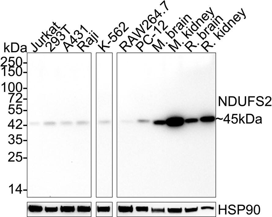 Western blot analysis on different lysates with NBP3-32638 at 1/2,000 dilution. Lane 1: Jurkat cell lysate (20 µg/Lane) Lane 2: 293T cell lysate (20 µg/Lane) Lane 3: A431 cell lysate (20 µg/Lane) Lane 4: Raji cell lysate (20 µg/Lane) Lane 5: K-562 cell lysate (20 µg/Lane) Lane 6: RAW264.7 cell lysate (20 µg/Lane) Lane 7: PC-12 cell lysate (20 µg/Lane) Lane 8: Mouse brain tissue lysate (40 µg/Lane) Lane 9: Mouse kidney tissue lysate (40 µg/Lane) Lane 10: Rat brain tissue lysate (40 µg/Lane) Lane 11: Rat kidney tissue lysate (40 µg/Lane) Predicted band size: 53 kDa Observed band size: 45 kDa Exposure time: 3 minutes;  4-20% SDS-PAGE gel. Proteins were transferred to a PVDF membrane and blocked with 5% NFDM/TBST for 1 hour at room temperature. NBP3-32638 at 1/2,000 dilution was used in 5% NFDM/TBST at 4℃ overnight. Goat Anti-Rabbit IgG [HRP] Secondary Antibody at 1/50,000 dilution was used for 1 hour at room temperature.