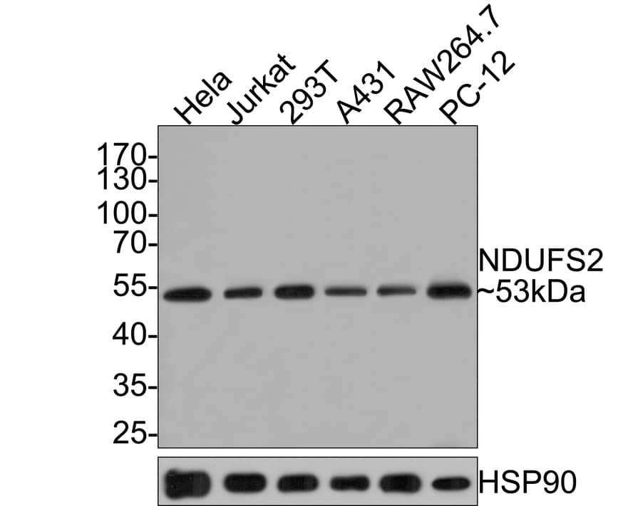 Western Blot: NDUFS2 Antibody (JE65-29) [NBP3-32638] - Western blot analysis of NDUFS2 on different lysates with Rabbit anti-NDUFS2 antibody (NBP3-32638) at 1/500 dilution. Lane 1: Hela cell lysate Lane 2: Jurkat cell lysate Lane 3: 293T cell lysate Lane 4: A431 cell lysate Lane 5: RAW264.7 cell lysate Lane 6: PC-12 cell lysate Lysates/proteins at 10 ug/Lane. Predicted band size: 53 kDa Observed band size: 53 kDa Exposure time: 2 minutes; 10% SDS-PAGE gel. Proteins were transferred to a PVDF membrane and blocked with 5% NFDM/TBST for 1 hour at room temperature. The primary antibody (NBP3-32638) at 1/500 dilution was used in 5% NFDM/TBST at room temperature for 2 hours. Goat Anti-Rabbit IgG - HRP Secondary Antibody at 1:300,000 dilution was used for 1 hour at room temperature.