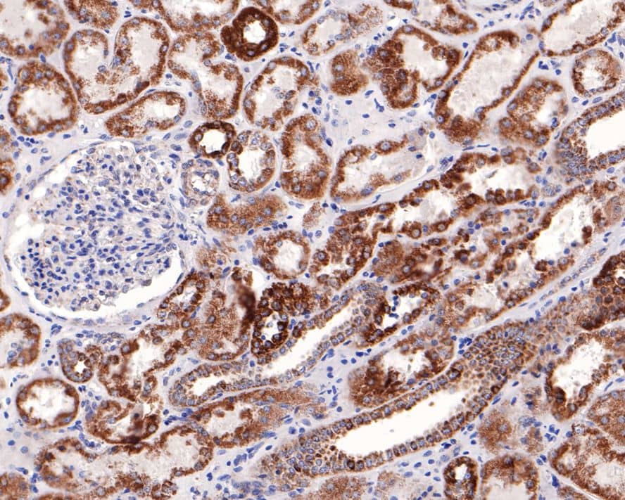 Immunohistochemistry: NDUFS2 Antibody (JE65-29) [NBP3-32638] - Immunohistochemical analysis of paraffin-embedded human kidney tissue with Rabbit anti-NDUFS2 antibody (NBP3-32638) at 1/100 dilution. The section was pre-treated using heat mediated antigen retrieval with Tris-EDTA buffer (pH 9.0) for 20 minutes. The tissues were blocked in 1% BSA for 20 minutes at room temperature, washed with ddH2O and PBS, and then probed with the primary antibody (NBP3-32638) at 1/100 dilution for 1 hour at room temperature. The detection was performed using an HRP conjugated compact polymer system. DAB was used as the chromogen. Tissues were counterstained with hematoxylin and mounted with DPX.