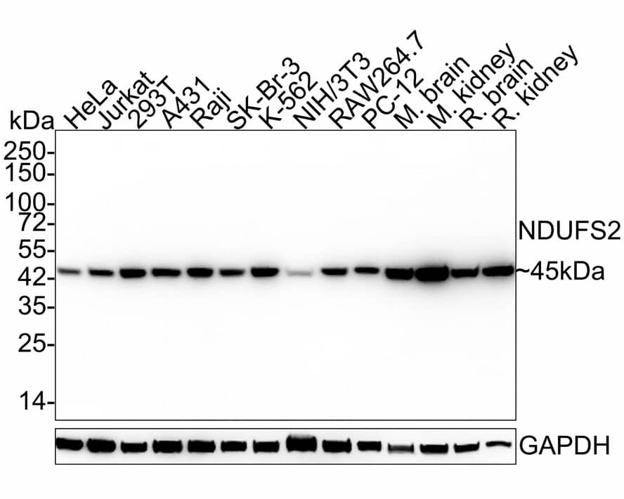 Western Blot: NDUFS2 Antibody (PSH03-26) [NBP3-32639] - Western blot analysis of NDUFS2 on different lysates with Rabbit anti-NDUFS2 antibody (NBP3-32639) at 1/2,000 dilution. Lane 1: HeLa cell lysate (20 ug/Lane) Lane 2: Jurkat cell lysate (20 ug/Lane) Lane 3: 293T cell lysate (20 ug/Lane) Lane 4: A431 cell lysate (20 ug/Lane) Lane 5: Raji cell lysate (20 ug/Lane) Lane 6: SK-Br-3 cell lysate (20 ug/Lane) Lane 7: K-562 cell lysate (20 ug/Lane) Lane 8: NIH/3T3 cell lysate (20 ug/Lane) Lane 9: RAW264.7 cell lysate (20 ug/Lane) Lane 10: PC-12 cell lysate (20 ug/Lane) Lane 11: Mouse brain tissue lysate (40 ug/Lane) Lane 12: Mouse kidney tissue lysate (40 ug/Lane) Lane 13: Rat brain tissue lysate (40 ug/Lane) Lane 14: Rat kidney tissue lysate (40 ug/Lane) Predicted band size: 53 kDa Observed band size: 45 kDa Exposure time: 24 seconds; 4-20% SDS-PAGE gel. Proteins were transferred to a PVDF membrane and blocked with 5% NFDM/TBST for 1 hour at room temperature. The primary antibody (NBP3-32639) at 1/2,000 dilution was used in 5% NFDM/TBST at 4  overnight. Goat Anti-Rabbit IgG - HRP Secondary Antibody at 1/50,000 dilution was used for 1 hour at room temperature.